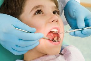 EL CONSUMO DE ALIMENTOS ricos en azúcares aunado a una pobre higiene dental promueve el desarrollo de caries.