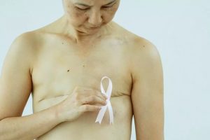 CÁNCER DE MAMA. La obesidad es un factor de riesgo para desarrollar la enfermedad después de la menopausia.