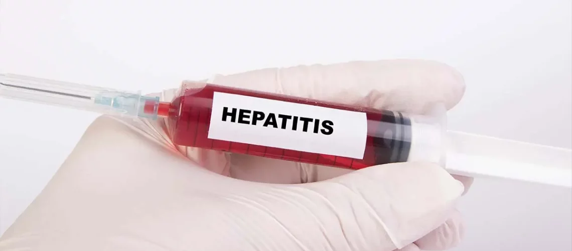 hepatitis-sintomas-unam