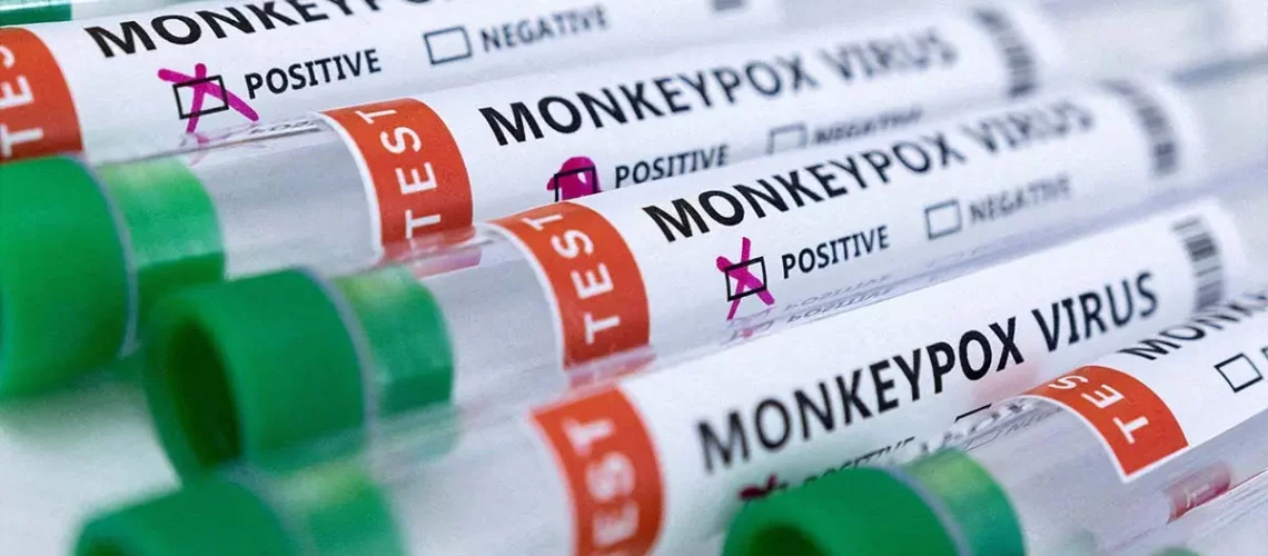 test viruela del mono